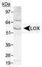 Lysyl Oxidase antibody, TA301449, Origene, Western Blot image 