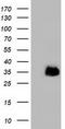 LRAT Domain Containing 2 antibody, TA501918, Origene, Western Blot image 