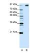 Splicing Factor 3b Subunit 1 antibody, NBP1-57192, Novus Biologicals, Western Blot image 