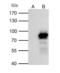 Phospholipase A2 Activating Protein antibody, GTX115226, GeneTex, Immunoprecipitation image 