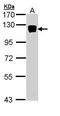 Xylosyltransferase 2 antibody, PA5-29127, Invitrogen Antibodies, Western Blot image 