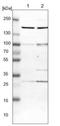 Probable histone-lysine N-methyltransferase NSD2 antibody, NBP1-82633, Novus Biologicals, Western Blot image 