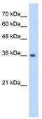 TruB Pseudouridine Synthase Family Member 2 antibody, TA346619, Origene, Western Blot image 
