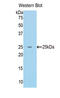 RAD50 Double Strand Break Repair Protein antibody, LS-C299176, Lifespan Biosciences, Western Blot image 