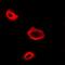 N(Alpha)-Acetyltransferase 50, NatE Catalytic Subunit antibody, orb341290, Biorbyt, Immunofluorescence image 
