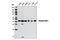 Vacuole Membrane Protein 1 antibody, 12929S, Cell Signaling Technology, Western Blot image 