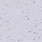 Cytidine Deaminase antibody, HPA064202, Atlas Antibodies, Immunohistochemistry frozen image 