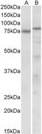Tumor Protein P63 antibody, STJ72516, St John