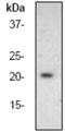 BCL2 Associated Agonist Of Cell Death antibody, TA300475, Origene, Western Blot image 
