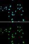 Nuclear Receptor Subfamily 5 Group A Member 2 antibody, GTX33366, GeneTex, Immunocytochemistry image 