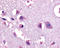 Corticotropin Releasing Hormone Receptor 1 antibody, TA340837, Origene, Immunohistochemistry frozen image 