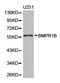 CDw293 antibody, A02722-1, Boster Biological Technology, Western Blot image 