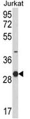 Killer Cell Lectin Like Receptor C1 antibody, AP18087PU-N, Origene, Western Blot image 