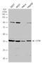 Cystathionine Gamma-Lyase antibody, GTX113409, GeneTex, Western Blot image 