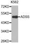 Adenylosuccinate synthetase isozyme 2 antibody, MBS129397, MyBioSource, Western Blot image 