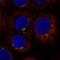 ArfGAP With Coiled-Coil, Ankyrin Repeat And PH Domains 1 antibody, NBP2-69009, Novus Biologicals, Immunofluorescence image 