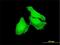F-Box And Leucine Rich Repeat Protein 22 antibody, H00283807-M01, Novus Biologicals, Immunofluorescence image 