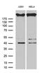 Gravin antibody, LS-C792709, Lifespan Biosciences, Western Blot image 