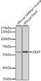 Carnitine O-Acetyltransferase antibody, 22-161, ProSci, Western Blot image 