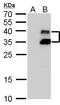 BARX Homeobox 1 antibody, GTX129470, GeneTex, Western Blot image 