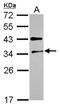 N(Alpha)-Acetyltransferase 80, NatH Catalytic Subunit antibody, NBP2-16548, Novus Biologicals, Western Blot image 