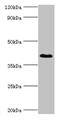 Dehydrogenase/Reductase 7 antibody, CSB-PA897480LA01HU, Cusabio, Western Blot image 