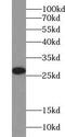 Ubiquitin C-Terminal Hydrolase L1 antibody, FNab09218, FineTest, Western Blot image 
