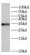 CDKN2A antibody, FNab02125, FineTest, Western Blot image 