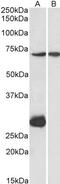 Carnitine O-palmitoyltransferase 2, mitochondrial antibody, PA5-19222, Invitrogen Antibodies, Western Blot image 