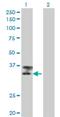 Titin antibody, H00007273-M09, Novus Biologicals, Western Blot image 