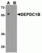 DEP Domain Containing 1B antibody, NBP2-81913, Novus Biologicals, Western Blot image 