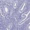 Acyl-CoA Synthetase Bubblegum Family Member 2 antibody, HPA051013, Atlas Antibodies, Immunohistochemistry frozen image 