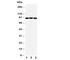 ATP Binding Cassette Subfamily B Member 6 (Langereis Blood Group) antibody, R30813, NSJ Bioreagents, Western Blot image 