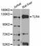 Toll Like Receptor 4 antibody, A5258, ABclonal Technology, Western Blot image 