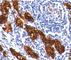 Thyroglobulin antibody, V7001-100UG, NSJ Bioreagents, Immunohistochemistry paraffin image 