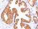 Ornithine Decarboxylase 1 antibody, NBP2-44732, Novus Biologicals, Immunohistochemistry frozen image 