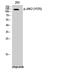 Janus Kinase 2 antibody, A00027Y570-1, Boster Biological Technology, Western Blot image 