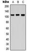 ArfGAP With SH3 Domain, Ankyrin Repeat And PH Domain 2 antibody, LS-B13654, Lifespan Biosciences, Western Blot image 