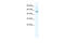 Sphingomyelin Phosphodiesterase Acid Like 3B antibody, 27-968, ProSci, Western Blot image 