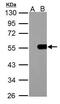 Inositol Hexakisphosphate Kinase 1 antibody, PA5-34730, Invitrogen Antibodies, Western Blot image 