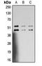Mitogen-Activated Protein Kinase 8 antibody, orb315601, Biorbyt, Western Blot image 