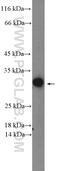 Regulator of G-protein signaling 4 antibody, 14530-1-AP, Proteintech Group, Western Blot image 