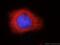 KOC antibody, 14642-1-AP, Proteintech Group, Immunofluorescence image 