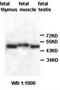 Zinc Finger And BTB Domain Containing 34 antibody, orb77477, Biorbyt, Western Blot image 