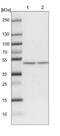 ElaC Ribonuclease Z 1 antibody, NBP1-85337, Novus Biologicals, Western Blot image 