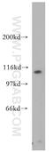 Adaptor Related Protein Complex 3 Subunit Delta 1 antibody, 16454-1-AP, Proteintech Group, Western Blot image 