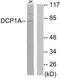 Decapping MRNA 1A antibody, TA326292, Origene, Western Blot image 