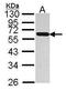 Protein Disulfide Isomerase Family A Member 5 antibody, TA308679, Origene, Western Blot image 