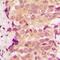 p38 antibody, LS-C368774, Lifespan Biosciences, Immunohistochemistry paraffin image 