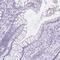 Melan-A antibody, HPA048662, Atlas Antibodies, Immunohistochemistry frozen image 